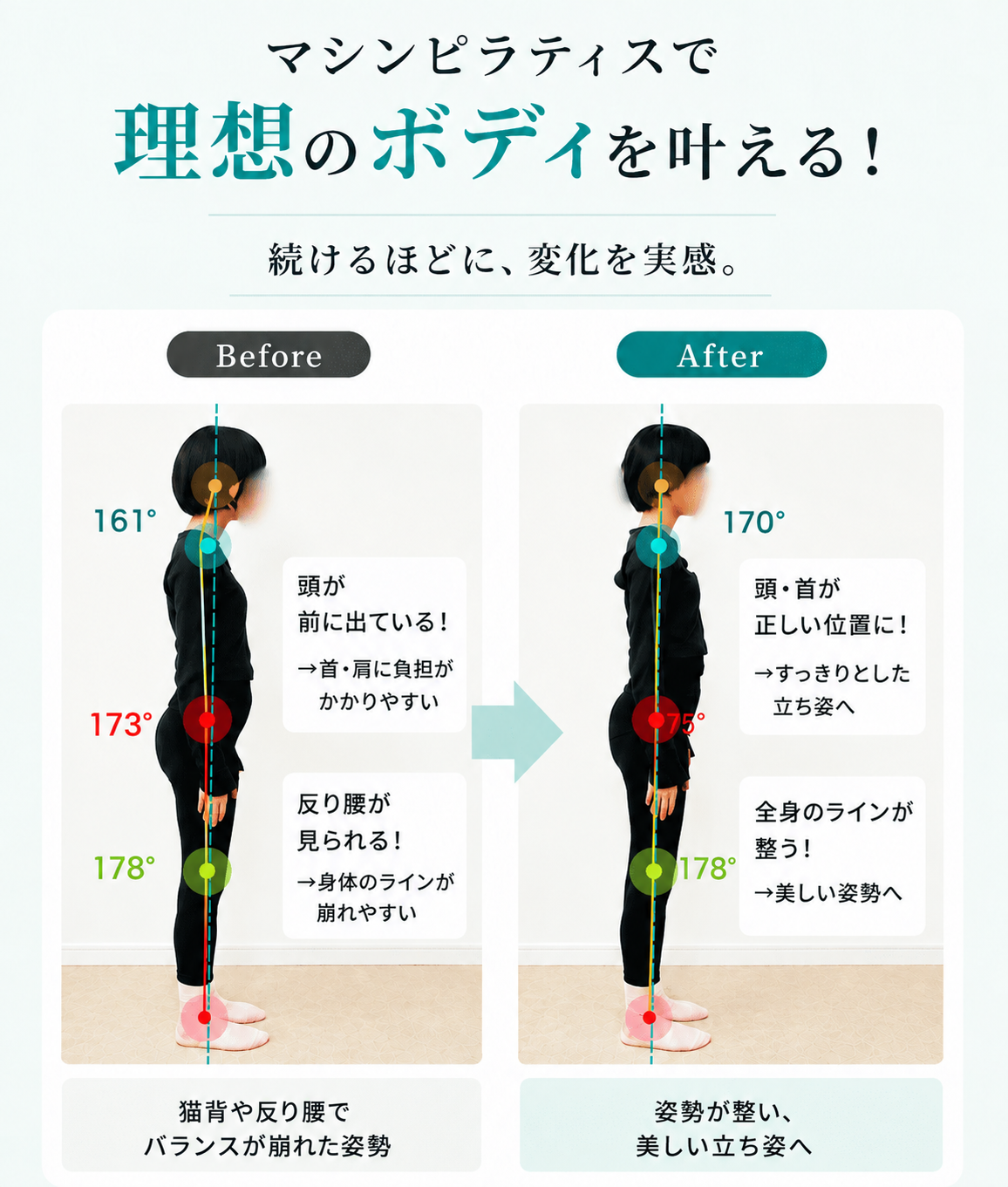 マシンピラティスによる姿勢のビフォーアフター